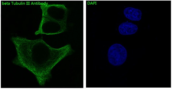 beta III Tubulin Rabbit mAb