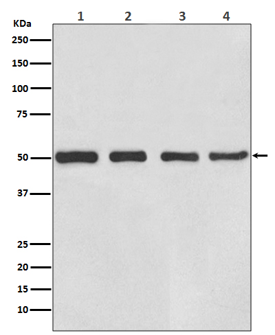 beta III Tubulin Rabbit mAb