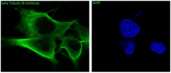 beta Tubulin Rabbit mAb