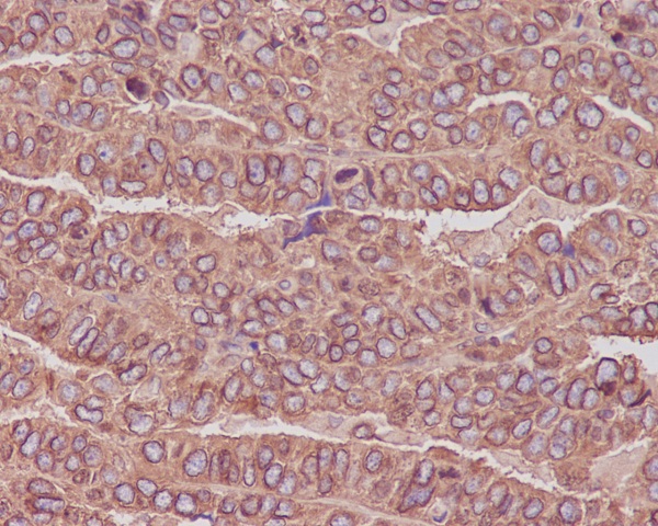 beta Tubulin Rabbit mAb