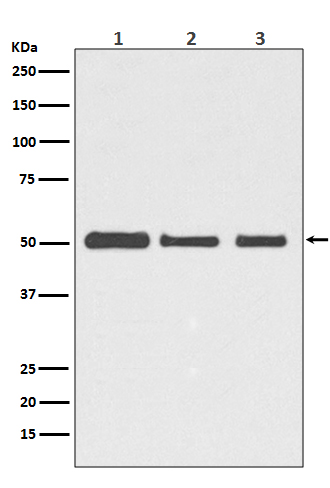 beta Tubulin Rabbit mAb