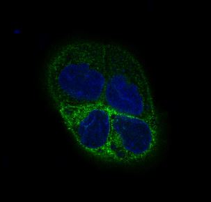 beta III Tubulin Rabbit mAb