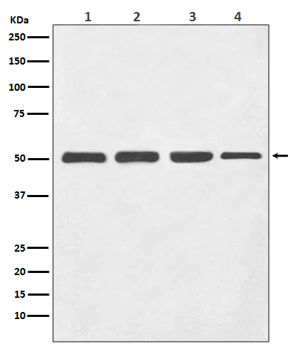 beta III Tubulin Rabbit mAb