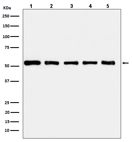 alpha Tubulin Rabbit mAb