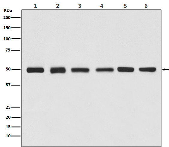 beta Tubulin Rabbit mAb (HRP conjugated)