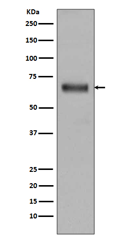 TGFBI Rabbit mAb