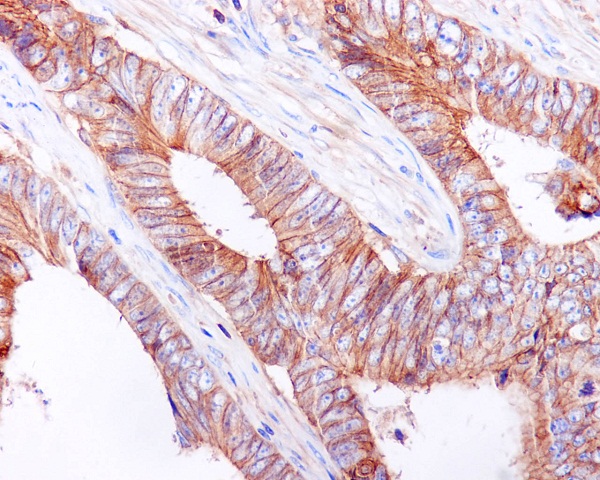 E Cadherin Rabbit mAb