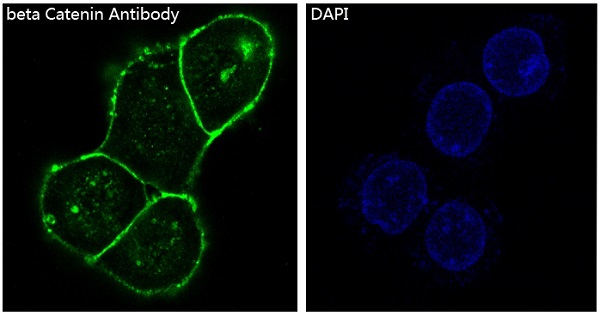 beta Catenin Rabbit mAb 