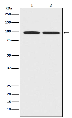 beta Catenin Rabbit mAb 