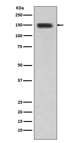 DSG1 Rabbit mAb