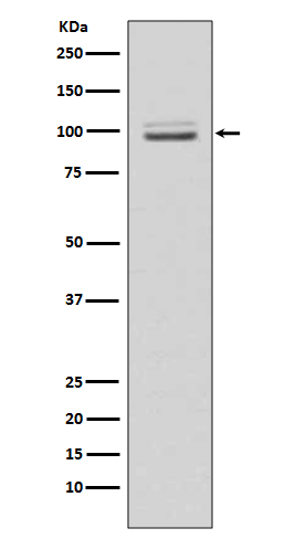 MKLP1 Rabbit mAb