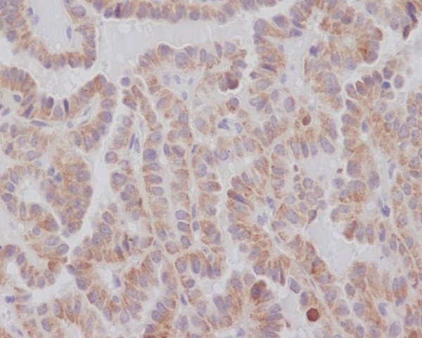 KIFC1 Rabbit mAb