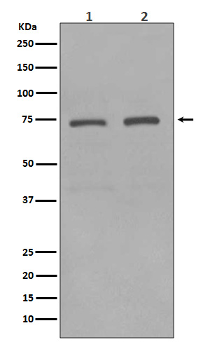 KIFC1 Rabbit mAb