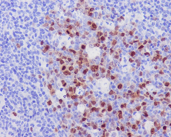 Aurora B Rabbit mAb