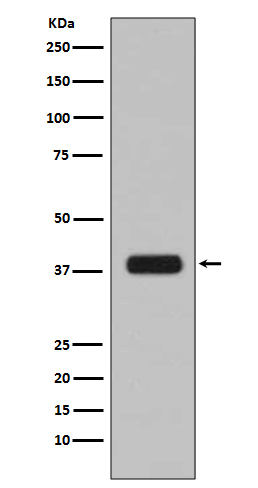 Aurora B Rabbit mAb