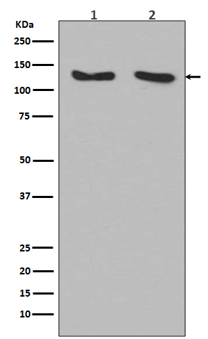 RNF20 Rabbit mAb