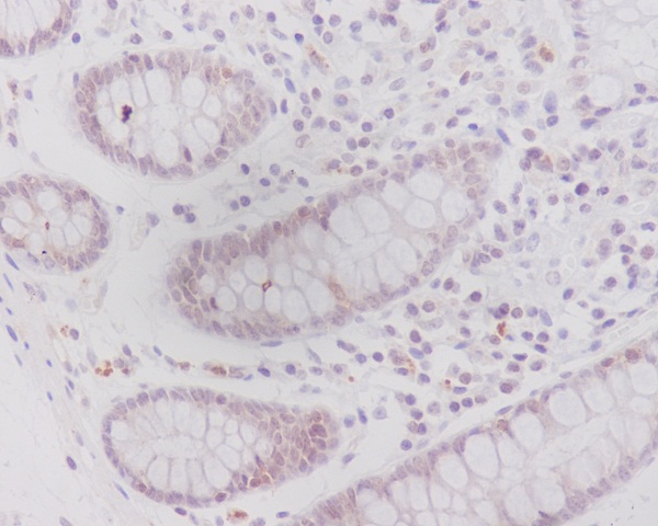 Caveolin-2 Rabbit mAb