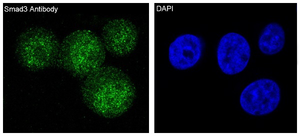 Smad3 Rabbit mAb