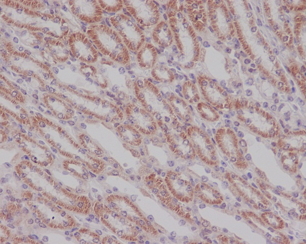 Smad3 Rabbit mAb