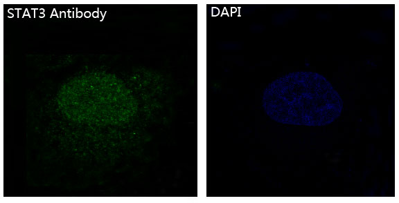 STAT3 Rabbit mAb