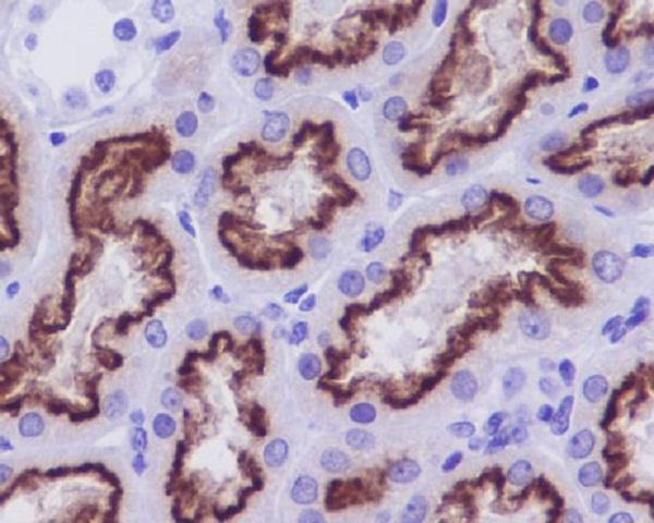 Cubilin Rabbit mAb