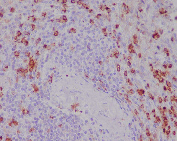 CD11b Rabbit mAb