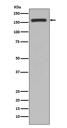 CD11b Rabbit mAb