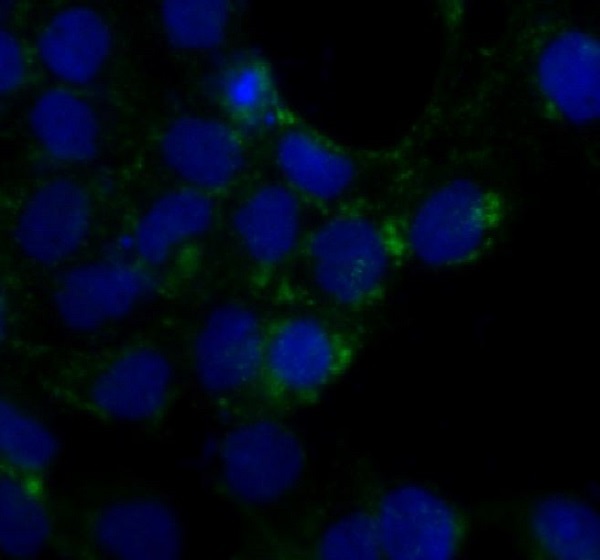 Caveolin-1 Rabbit mAb