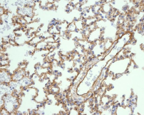 Caveolin-1 Rabbit mAb