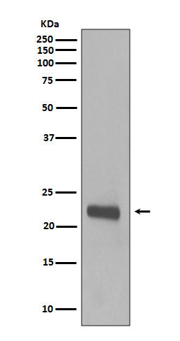 Caveolin-1 Rabbit mAb