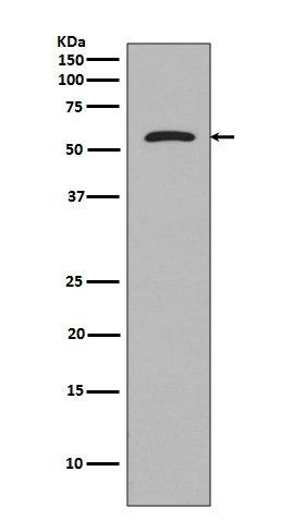 Tau Rabbit mAb