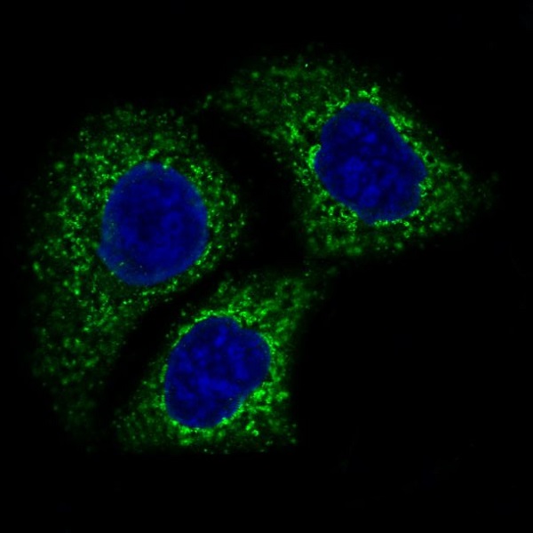 AIF Rabbit mAb