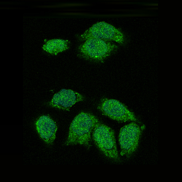 IKB alpha Rabbit mAb