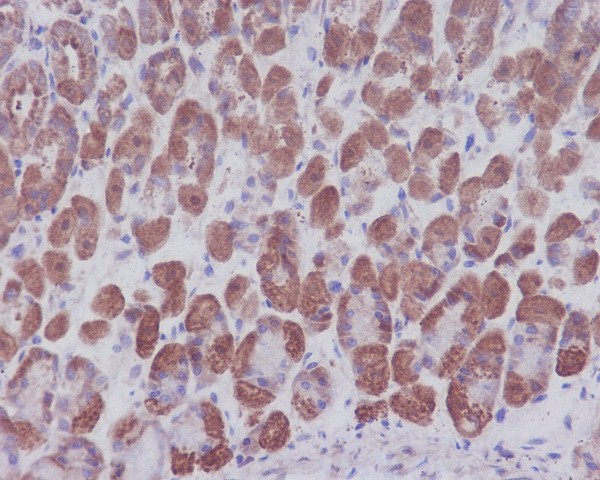 IKB alpha Rabbit mAb