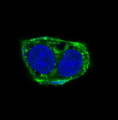 alpha smooth muscle Actin Rabbit mAb