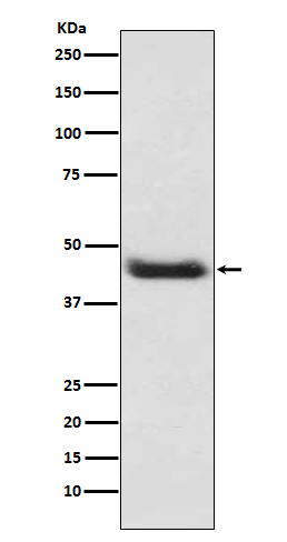 alpha smooth muscle Actin Rabbit mAb