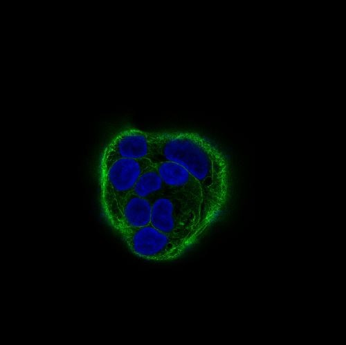 Cytokeratin 18 Rabbit mAb