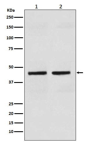 Cytokeratin 18 Rabbit mAb