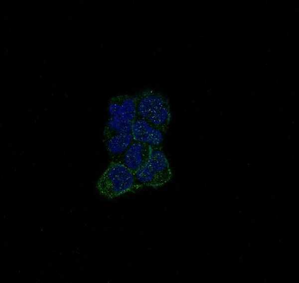 ErbB4 (HER4) Rabbit mAb