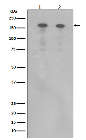 ErbB4 (HER4) Rabbit mAb