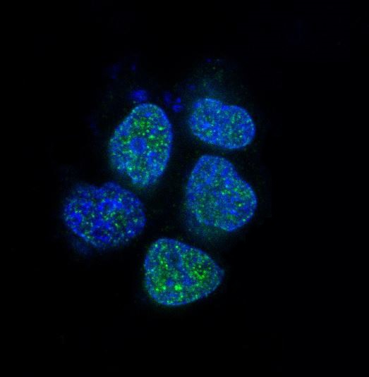 Androgen Receptor Rabbit mAb