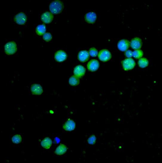 Bcl-2 Rabbit mAb