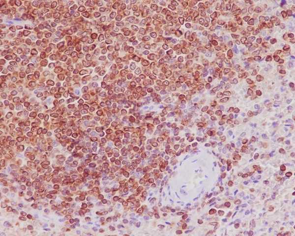 Bcl-2 Rabbit mAb