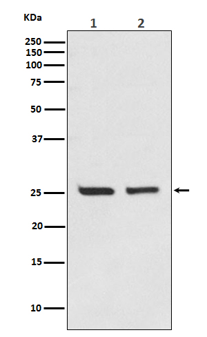 Bcl-2 Rabbit mAb