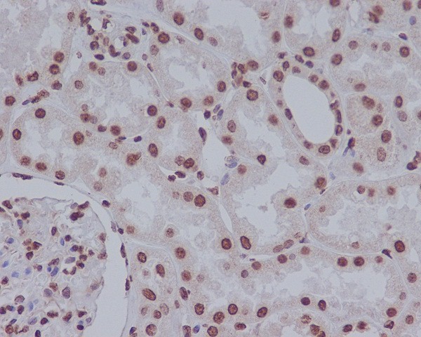 Cleaved PARP Rabbit mAb