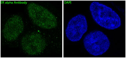 ER alpha Rabbit mAb