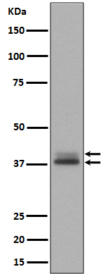 Phospho-Erk1 (T202/Y204) + Erk2 (T185/Y187) Rabbit mAb