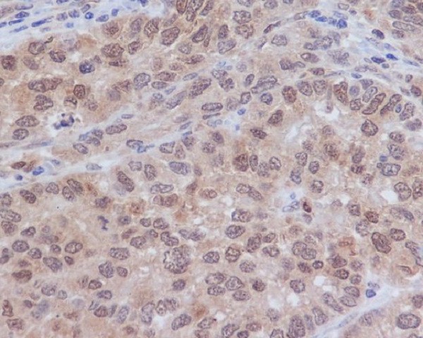 ERK2 Rabbit mAb