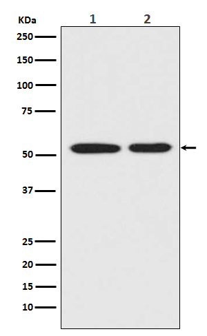 Mutant p53 Rabbit mAb