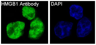 HMGB1 Rabbit mAb